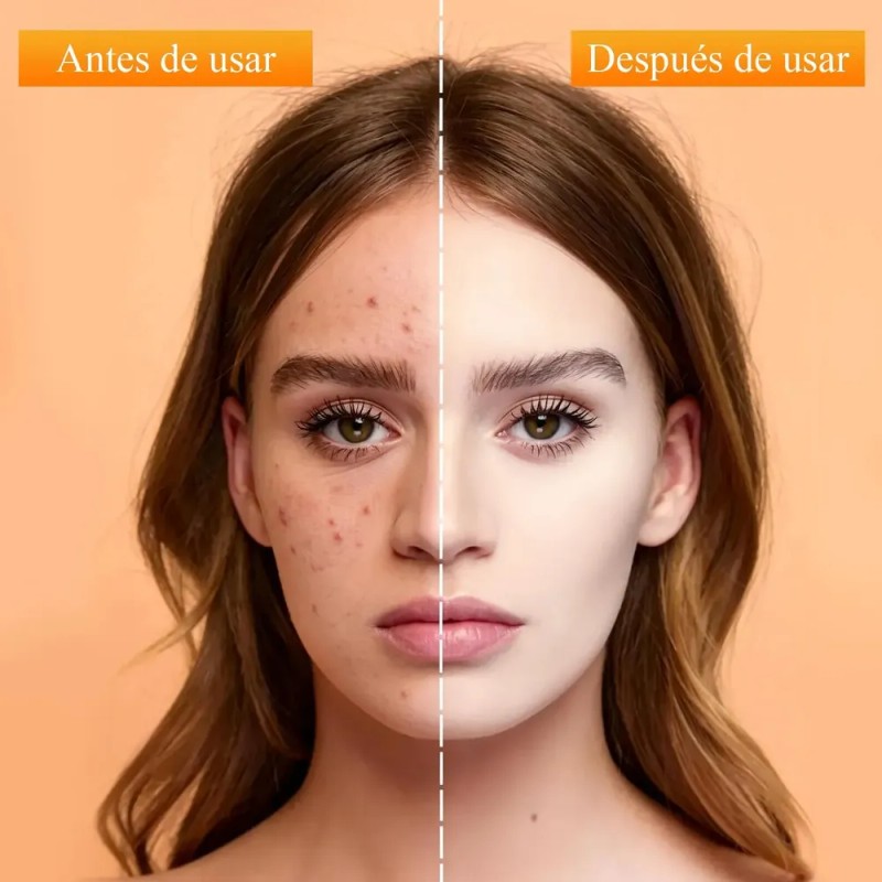 ****** Crema En Gel Hidratante Calmante Para Manchas Oscuras