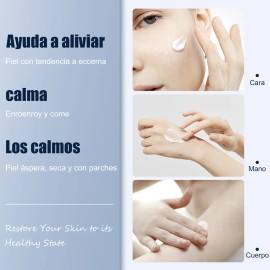 Crema Eczema Hidratante, Aliviar Piel Seca Y Picazón 20g
