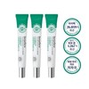 Benefere TCS Recovery Eye Bag Dark Circle Care Eye Cream 20ml 3pcs / 베네페레 TCS 리커버리 아이백 다크서클 케어 아이 크림 20ml 3개