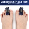 Ajoysoul Toe Splint for Women & Men, Adjustable Straightener Relief