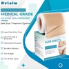 Silicone Scar Sheets, Silicone Scar Tape(1.8”x 157” Roll-4M), Silicone Scar