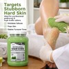 Spa Redi – Exfoliante, hidratante y nutritivo, impregnado con aceites