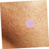 Baluue 5 Sheets Facial Mole Patches for Stickers Pimple Patches