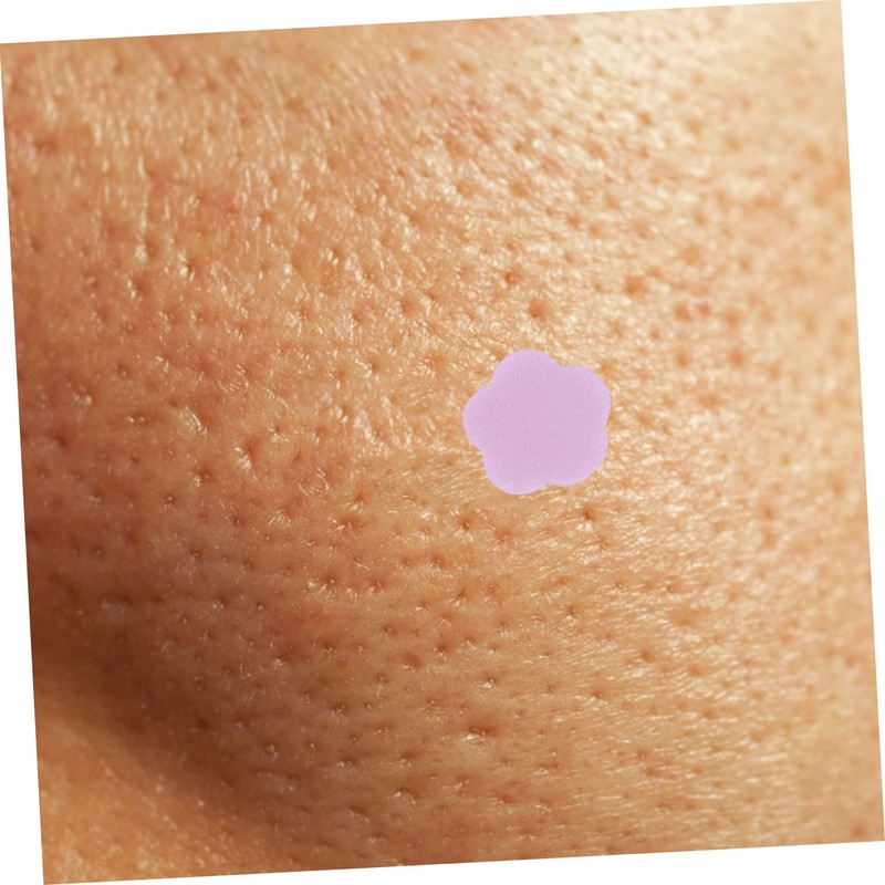 Baluue 5 Sheets Facial Mole Patches for Stickers Pimple Patches