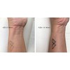 GZ558x2 Temporary Dandelion Tattoo Flowers Tattoo Dandelions Semi-Permanent Tattoo Long-Lasting