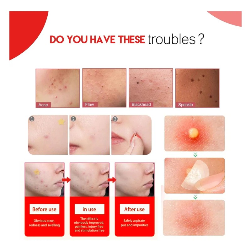 🔥 240pzs mascarillas parches para el acne espinillas granos Vitaminas