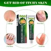 Psoriasis Cream, Care Cream, Limplify Psoriasis Cream, Psoriasis Cream, Psoriasis