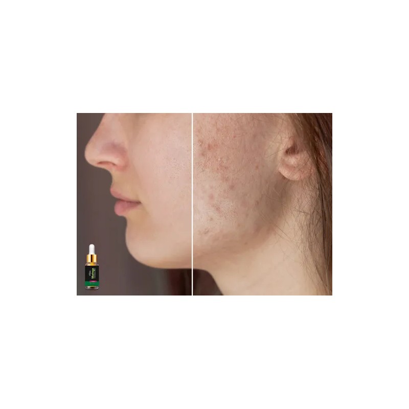 Crema + Aceite De Moringa Antiarrugas Antimanchas Antiedad