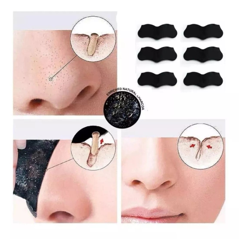 Total Supplier Nose Strip Limpieza De Poros De Nariz (puntos