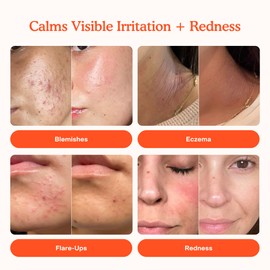 Tower 28 Tower 28 SOS Daily Rescue Facial Spray for Sensitive Skin, Hypochlorous Acid Spray Helps Reduce Redness and Breakouts, Travel Size Toner for Face, 1 FL Oz