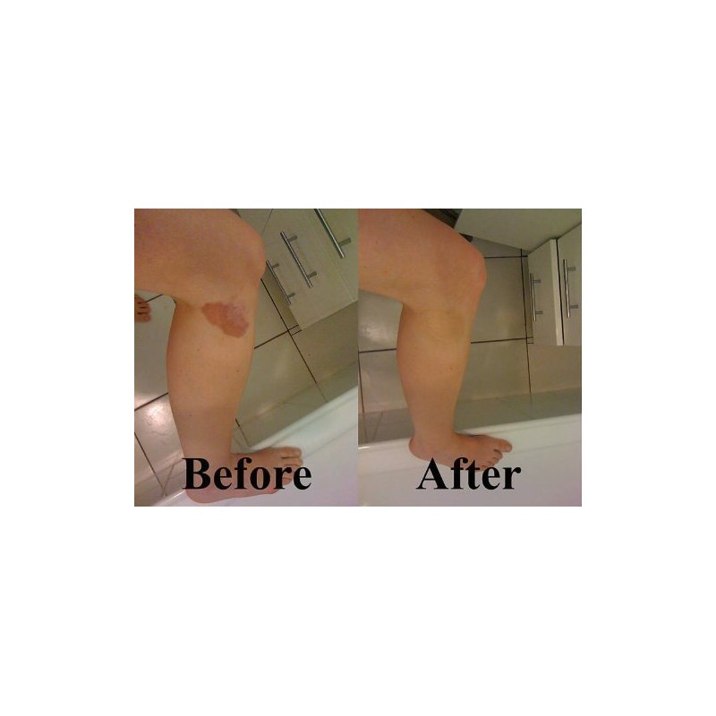 Hide Ink Temporary Tattoo Cover Up 4" x 6" -