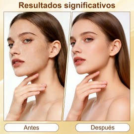 Crema Reafirmante para el Cuello, Crema Reafirmante para el Cuello con Doble Rodillo, Reduce Arrugas, Líneas Finas y Papada, Reafirma la Piel.