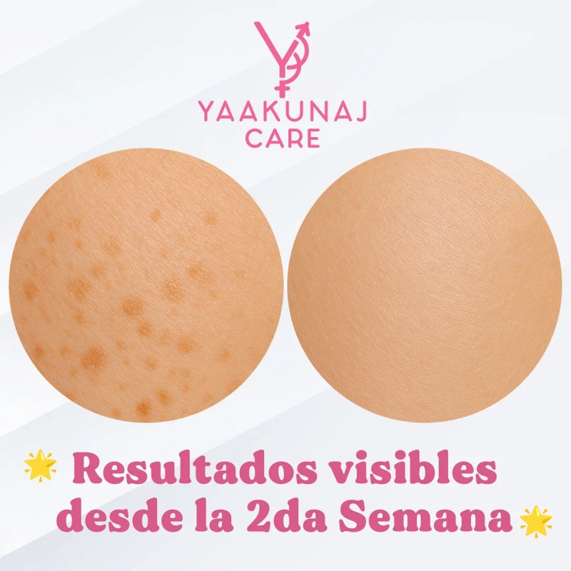 Crema Iluminadora Yaakunaj Care 100ml Zonas Íntimas
