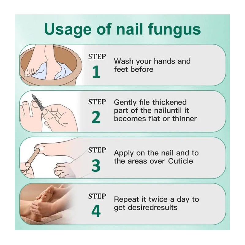 Ungüento Para Hongos En Las Uñas Tratamiento Efectivo 20g