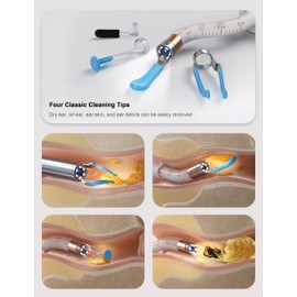 BEBIRD Earsight Plus Ear Wax Removal Tool Camera with HD Visual Otoscope, Smart WiFi Earwax Cleaner Kit, Safe Silicone Flexible Scoops & Tweezers Tools for Adults & Kids, Ear Canal Cleaning Kits