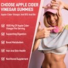 Keto Apple Cider Vinegar Gummies, Keto ACV Gummy Diet Supplement,