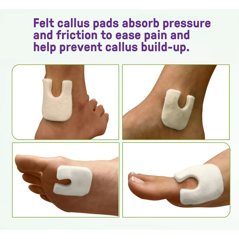 Wide U Shaped Felt Callus Horseshoe Metatarsal Pads Adhesive Foot