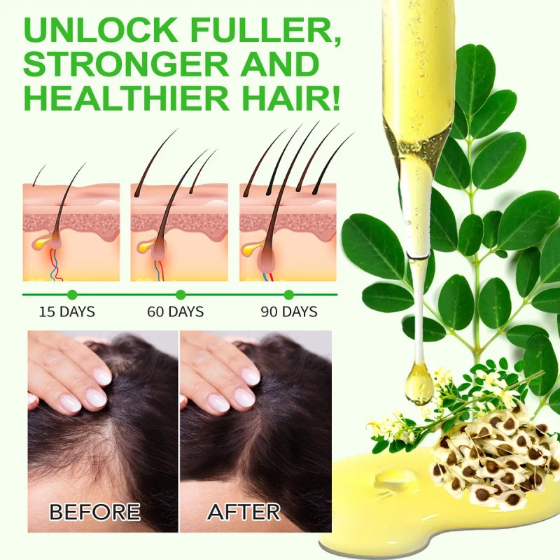 Aceite Moringa Crecimiento Capilar Antiedad Terapéutico