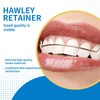 Hawley Retainers for Adults, Custom Retainers for Upper and Lower