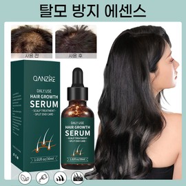 탈모 앰플 모발 성장 에센스 식물 생강 헤어 영양제 머리 발모제 두피 영양 탈모 세럼 머릿결 개선, 30ml, 1개 Hair Loss Ampoule Hair Growth Essence Plant Ginger Hair Nutrient Hair Regrowth Scalp Nutrient Hair Loss Serum Hair Quality Improvement, 30ml, 1 piece