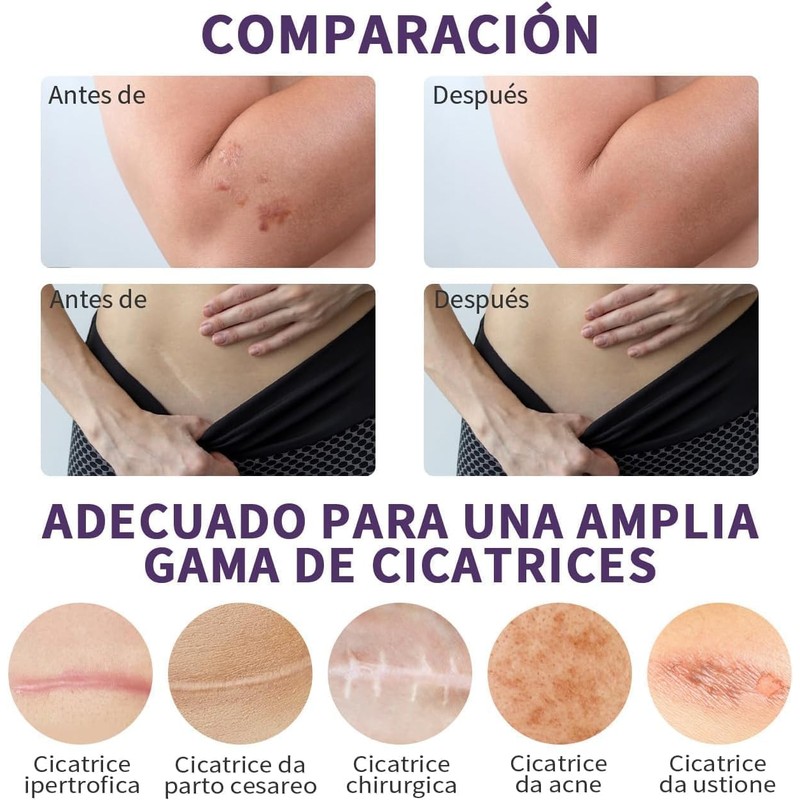 Cinta de silicona para cicatrices, (rollo de 4cm x 1.5