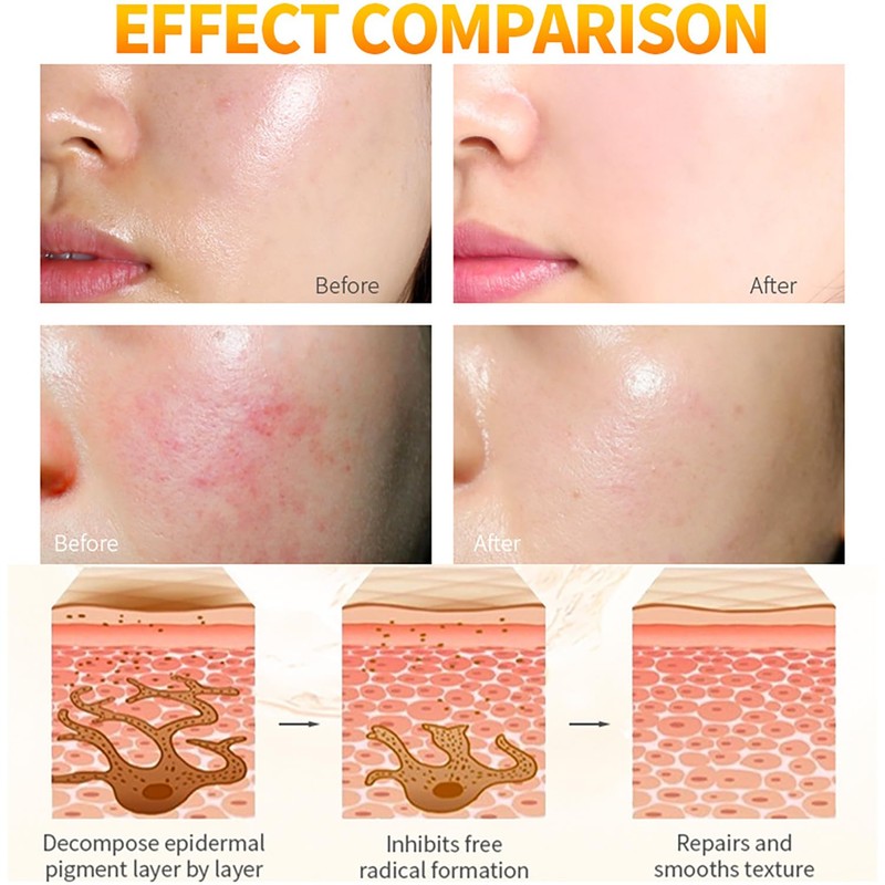 DISAAR Beauty Moisturizing Repair Fine Lines Cream Vitamin C Arbutin