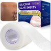 Hojas de silicona para eliminar cicatrices, hoja de silicona profesional