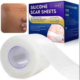 Hojas de silicona para eliminar cicatrices, hoja de silicona profesional para cicatrices causadas por cesárea, cirugía, quemaduras, acné, estrías y má