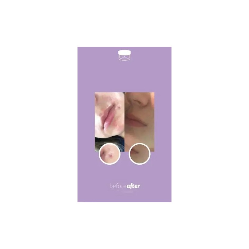 Juveness Crema Facial Hipoalergénica Sublime Cover Sens Piel Sensible 50mL