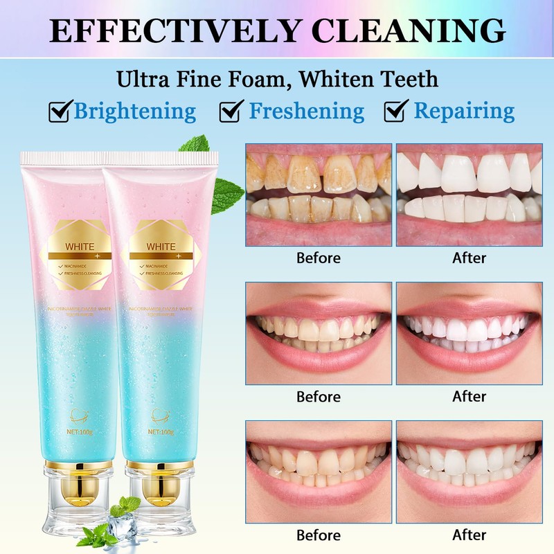 Acssart Radiant Whitening Toothpaste, Niacinamide Whitening Toothpaste, Niacinamide Dazzling Toothpastes