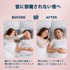 Dentellea Mouthpiece, Snoring, Night Guard, Bruxism, Sleeping, Sleeping Support, Reusable