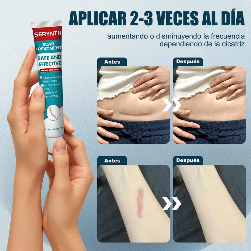 Crema Para Cicatrices, Elimina Cicatrices Y Quemaduras 20g