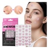 36pcs Salicylic Acid Ance Patch Skincare Large Capacity