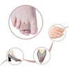 LHKJ Pack of 10 Hammer Toe Bandages, Toe Corrector Bandages,