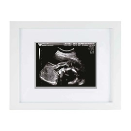Pearhead Sonogram Keepsake Frame, Mothering Sunday Mother's Day Expecting or New Mum Gift, White