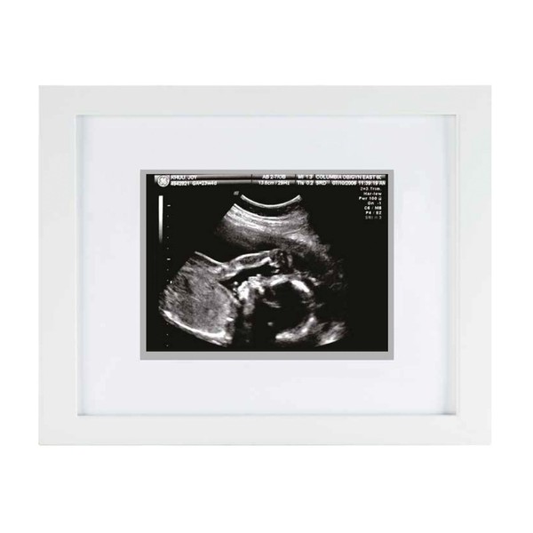 Pearhead Sonogram Keepsake Frame, Mothering Sunday Mother's Day Expecting or