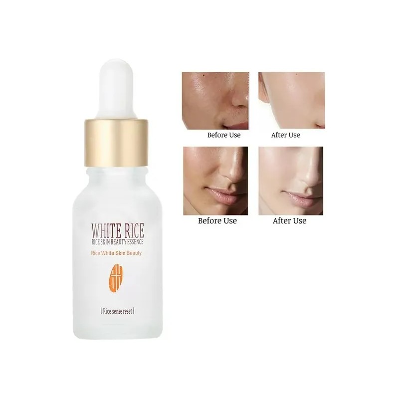 Esencia Facial De Arroz Hidratante Aclarante Suavizante Mixta
