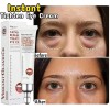 2PCS Instant Remove Dark Circles Wrinkles Face Lines Puffy Eyes