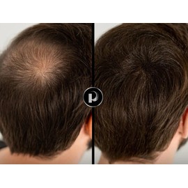 2 piezas Capelli 33 g Microfibras Capilares, apariencia cabello abundante, volumen en segundos, cabeza, barba y bigote (Castaño oscuro)