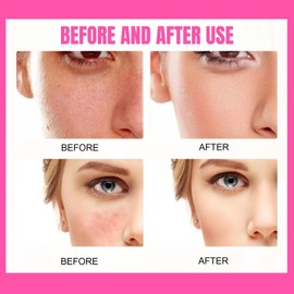 Peptide Balm Foundation,P/eptide Bounce Balm F/oundation,Hydrating Pe/ptide Balm Makeup,Fo/undation Full Coverage,Cream Fou/ndation,Coverage Balms Foun/dation M/akeup,Lightweight Makeup Foundation