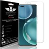 TECHGEAR Screen Protector fits Honor Magic 4 Pro 5G [Screen