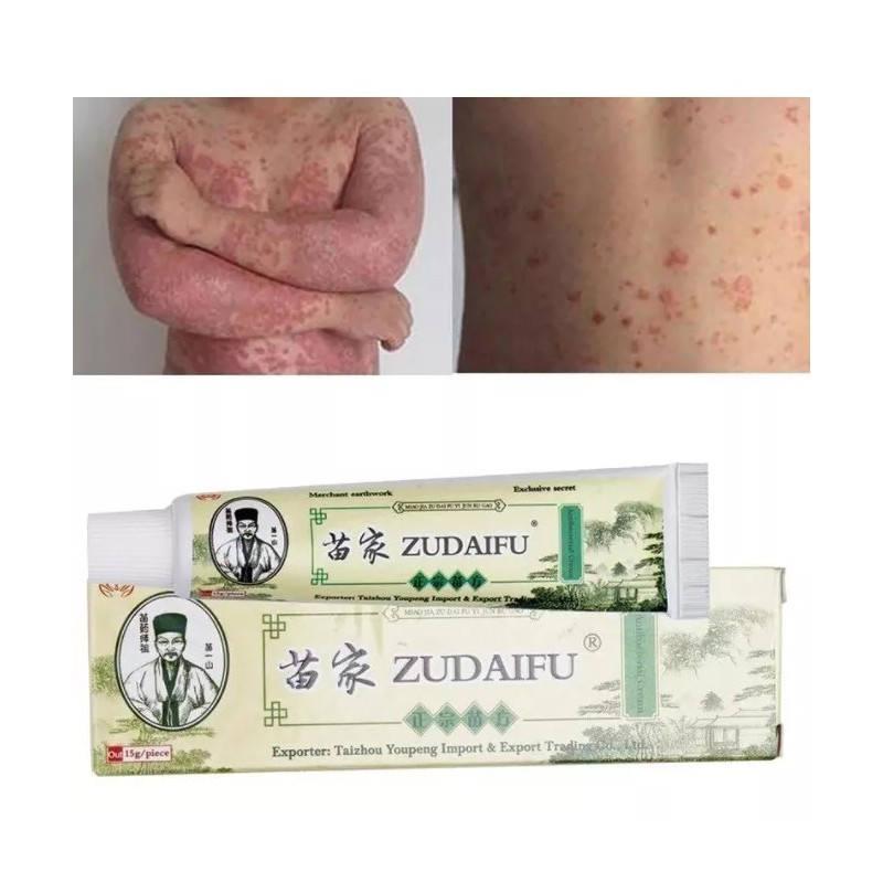 Zudaifu 1 Crema Zudaifu Empaque Original Efectiva Psoriasis Y Eczema