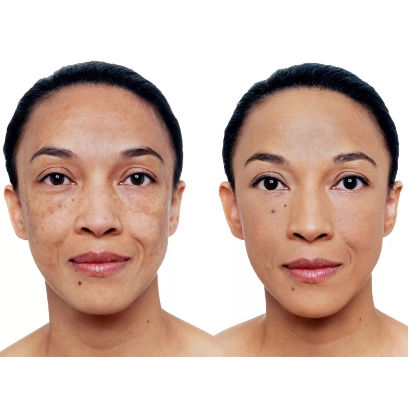 Vichy DERMABLEND Corrective Fluid Foundation 30ml. 16h. - 55 -