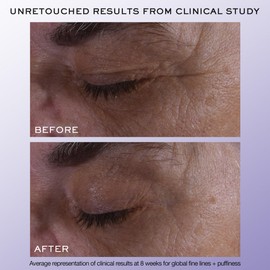 Lancôme Rénergie Triple Serum Eye Serum - 20ml