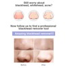 Blackhead Vacuum Cleaner Suction Power Multi Functional Facial Suction Pore