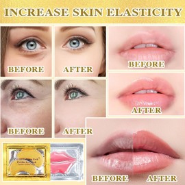 10pcs Parches Ojos Bolsas y Ojeras+10pcs Parche Labial, Eye Patches Eye Mask, Máscaras Gel para Ojos, Hidratación Ojeras, Colágeno Lip Mask, Máscara De Labios Eliminación Ojos Bolsas y Ojeras, Parches para Antiarrugas, Parches Ojeras
