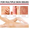Pomada Herbal Antibacterial para Cuidado de la Piel Sensible Irritación,