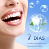 tiras blanqueadoras de dientes,tiras blanqueadoras dientes,tiras blanqueadoras，15 Pares (30 Tiras)