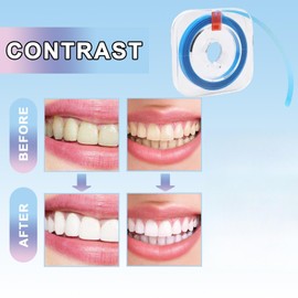 Tooth Polishing Strips,Resin Tooth Whitening Strips,Tooth Polishing Grinding Strips,Tooth Sandpaper,Interdental Grinding Tools,Grinding Tools,Tooth Polishing Grinding Kits, Household,Fresh Breath