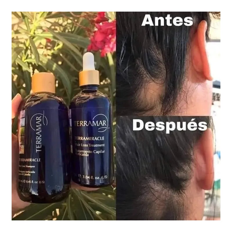 3 Shampoo Anticaída Extracto Romero Y Limón Terramar /250ml